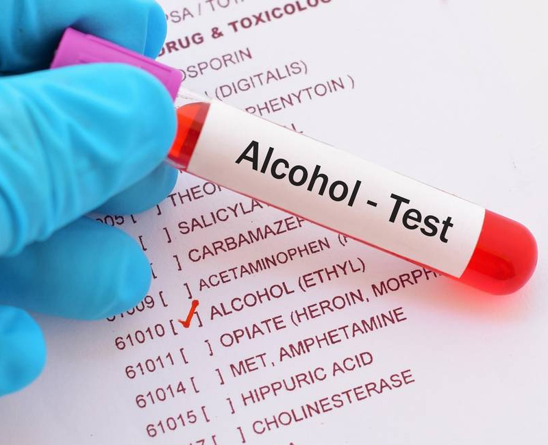 alcol test – Farvisan